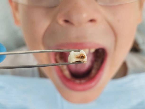 Fast & Reliable Emergency Dental Services in MO
